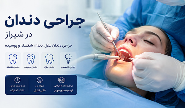 جراحی دندان عقل؛ نهفته و پوسیده در شیراز